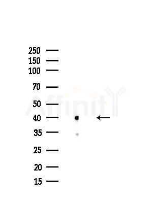 PCBP2 Antibody - Western blot analysis of lysates from HUVEC cells(starvation,24h treatment), using PCBP2 Antibody at 1/1000 dilution.