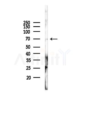 TMPO Antibody - Western blot analysis of lysates from Rat liver, using TMPO Antibody at 1/1000 dilution.