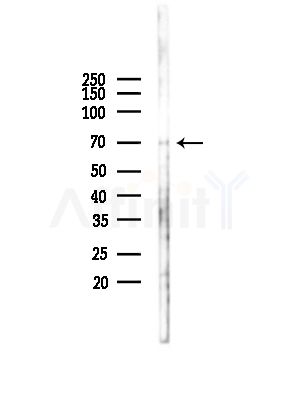 TMPO Antibody - Western blot analysis of lysates from COLO205 cells(UV,30min treatment), using TMPO Antibody at 1/1000 dilution.