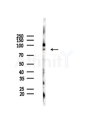 Integrin beta3 Antibody - Western blot analysis of lysates from HepG2 cells(LPS,4h treatment), using Integrin beta3 Antibody at 1/1000 dilution.