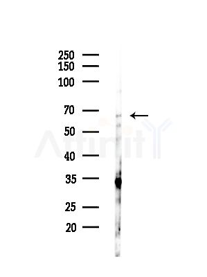 CD16 Antibody - Western blot analysis of lysates from HepG2 cells(LPS,4h treatment), using CD16 Antibody at 1/1000 dilution.