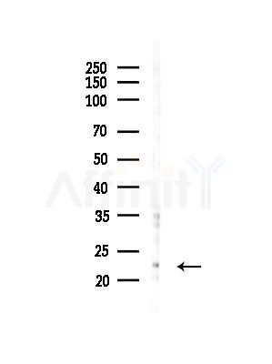 DIABLO Antibody - Western blot analysis of lysates from PC12 cells(LPS,4h treatment), using DIABLO Antibody at 1/1000 dilution.