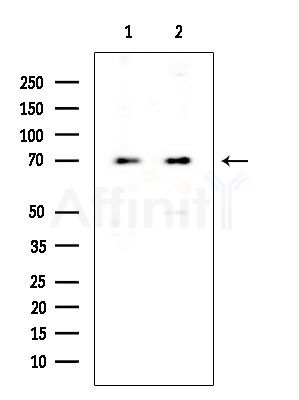 PRKG1 Antibody - Western blot analysis of extracts from various samples, using PRKG1 Antibody at 1/1000 dilution.