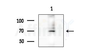 PRKG1 Antibody - Western blot analysis of extracts from Mouse lung, using PRKG1 Antibody at 1/1000 dilution.