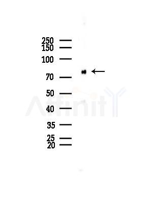 PRKG1 Antibody - Western blot analysis of lysates from COLO205 cells, using PRKG1 Antibody at 1/1000 dilution.