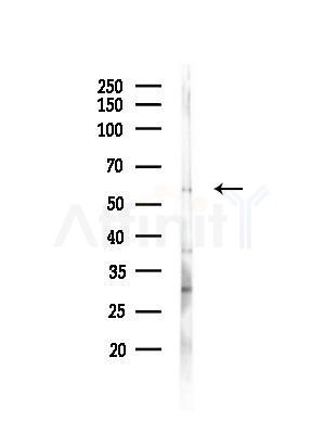 N-WASP Antibody - Western blot analysis of lysates from Mouse brain, using N-WASP Antibody at 1/1000 dilution.