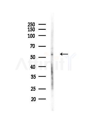 N-WASP Antibody - Western blot analysis of lysates from Hela cells(LPS,4h treatment), using N-WASP Antibody at 1/1000 dilution.