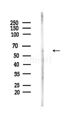 CD19 Antibody - Western blot analysis of lysates from Hela cells(LPS,4h treatment), using CD19 Antibody at 1/1000 dilution.