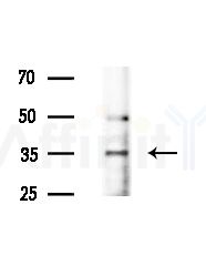 CEACAM3 Antibody - Western blot analysis of extracts from Mouse brain, using CEACAM3 Antibody at 1/1000 dilution.