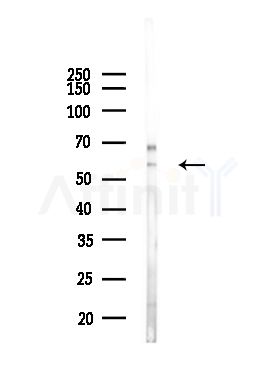 Cytokeratin 4 Antibody - Western blot analysis of lysates from Mouse lung, using Cytokeratin 4 Antibody at 1/1000 dilution.