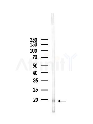 CCL24 Antibody - Western blot analysis of lysates from Mouse liver, using CCL24 Antibody at 1/1000 dilution.