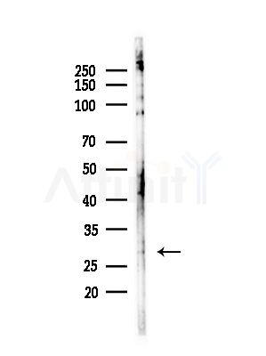 CLEC4D Antibody - Western blot analysis of lysates from HepG2 cells(LPS,4h treatment), using CLEC4D Antibody at 1/1000 dilution.