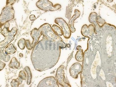 CNTFR Antibody - DF7058 at 1/100 staining human normal placenta tissue by IHC-P.