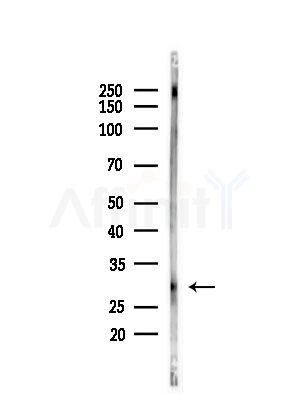 CLEC4A Antibody - Western blot analysis of lysates from LoVo cells(heat-shock,45min treatment), using CLEC4A Antibody at 1/1000 dilution.