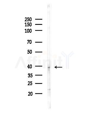 DLK1 Antibody - Western blot analysis of lysates from Hela cells(starvation,24h treatment), using DLK1 Antibody at 1/1000 dilution.