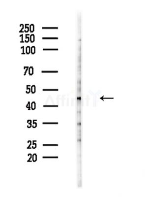 GNAS Antibody - Western blot analysis of lysates from Hela cells(LPS,4h treatment), using GNAS Antibody at 1/1000 dilution.