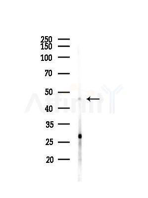 NAP1L1 Antibody - Western blot analysis of lysates from MDA-MB-231 cells(heat-shock,45min treatment), using NAP1L1 Antibody at 1/1000 dilution.