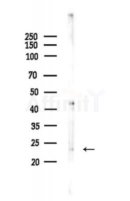 NEUROG3 Antibody - Western blot analysis of lysates from LoVo cells(heat-shock,45min treatment), using NEUROG3 Antibody at 1/1000 dilution.