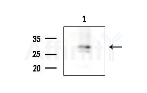 PDCD10 Antibody - Western blot analysis of extracts from EC304 cells, using PDCD10 Antibody at 1/1000 dilution.