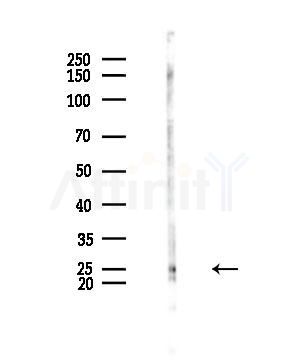 PDCD10 Antibody - Western blot analysis of lysates from EC304 cells, using PDCD10 Antibody at 1/1000 dilution.