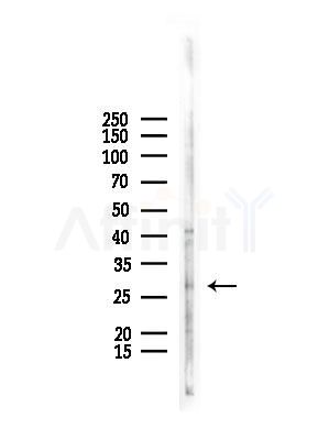 AQP0 Antibody - Western blot analysis of lysates from COLO205 cells, using AQP0 Antibody at 1/1000 dilution.