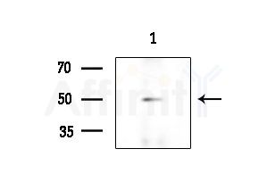DRD4 Antibody - Western blot analysis of extracts from HepG2 cells(UV 30min treatment), using DRD4 Antibody at 1/1000 dilution.