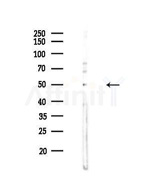 DRD4 Antibody - Western blot analysis of lysates from HepG2 cells(UV,30min treatment), using DRD4 Antibody at 1/1000 dilution.