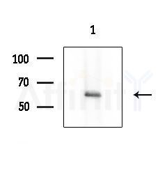 GAD1 Antibody - Western blot analysis of extracts from COLO205 cells, using GAD1 Antibody at 1/1000 dilution.
