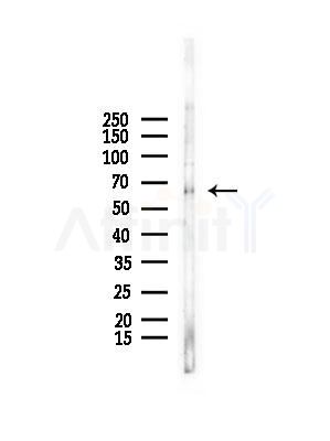 GAD1 Antibody - Western blot analysis of lysates from COLO205 cells, using GAD1 Antibody at 1/1000 dilution.