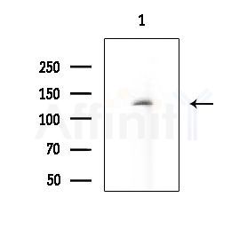 TERT Antibody - Western blot analysis of extracts from Mouse lung, using TERT Antibody at 1/1000 dilution.