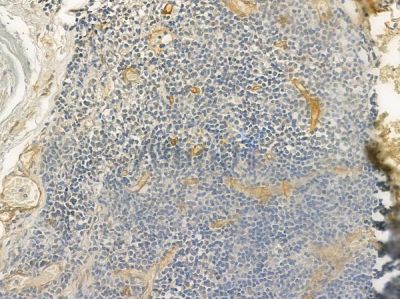 KCNA1 Antibody - DF7138 at 1/100 staining human normal tonsil tissue by IHC-P.