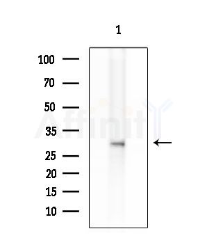 MC2R Antibody - Western blot analysis of extracts from K562 cells, using MC2R Antibody at 1/1000 dilution.