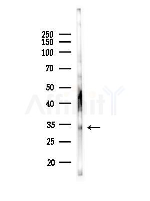 MC2R Antibody - Western blot analysis of lysates from K562 cells, using MC2R Antibody at 1/1000 dilution.
