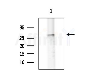 MC5R Antibody - Western blot analysis of extracts from K562 cells, using MC5R Antibody at 1/1000 dilution.