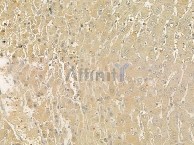 SLC16A4 Antibody - DF7145 at 1/100 staining human normal liver tissue by IHC-P.