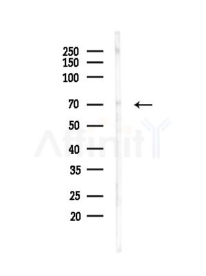 MMP25 Antibody - Western blot analysis of lysates from Mouse testis, using MMP25 Antibody at 1/1000 dilution.