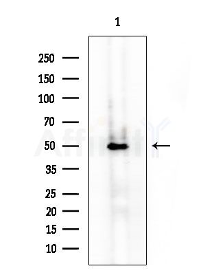 MMP11 Antibody - Western blot analysis of extracts from Rat liver, using MMP11 Antibody at 1/1000 dilution.