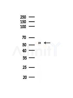 MMP11 Antibody - Western blot analysis of lysates from Rat liver, using MMP11 Antibody at 1/1000 dilution.