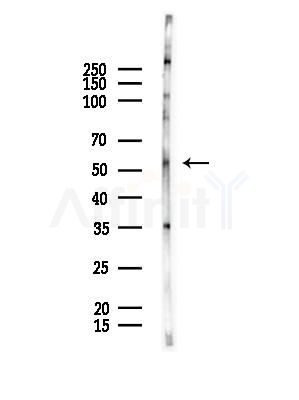 MMP11 Antibody - Western blot analysis of lysates from Mouse brain, using MMP11 Antibody at 1/1000 dilution.