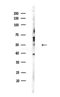 PDK4 Antibody - Western blot analysis of lysates from A375 cells(LPS,4h treatment), using PDK4 Antibody at 1/1000 dilution.