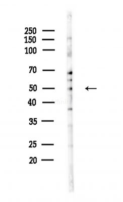 PDK4 Antibody - Western blot analysis of lysates from Hela cells(heat-shock,45min treatment), using PDK4 Antibody at 1/1000 dilution.