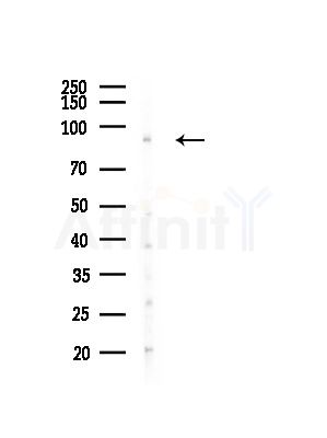 PIBF1 Antibody - Western blot analysis of lysates from A375 cells(heat-shock, 45min treatment), using PIBF1 Antibody at 1/1000 dilution.