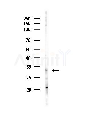 GEMIN2 Antibody - Western blot analysis of lysates from Hela cells(starvation,24h treatment), using GEMIN2 Antibody at 1/1000 dilution.