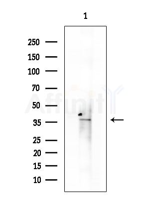 TCF7 Antibody - Western blot analysis of extracts from EC304 cells, using TCF7 Antibody at 1/1000 dilution.