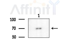 TRAF7 Antibody - Western blot analysis of extracts from COLO205 cells, using TRAF7 Antibody at 1/1000 dilution.
