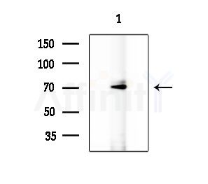 TRAF7 Antibody - Western blot analysis of extracts from K562 cells, using TRAF7 Antibody at 1/1000 dilution.