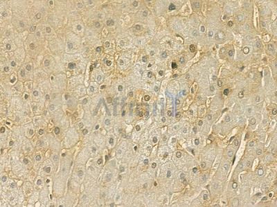 TRAF7 Antibody - DF7182 at 1/100 staining human normal liver tissue by IHC-P.