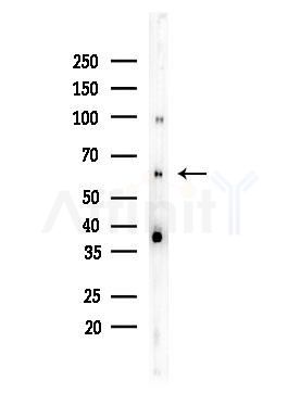 TRAF7 Antibody - Western blot analysis of lysates from COLO205 cells, using TRAF7 Antibody at 1/1000 dilution.