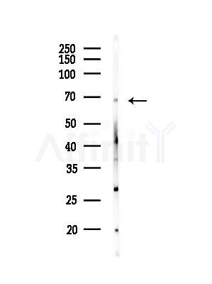 TRAF7 Antibody - Western blot analysis of lysates from K562 cells, using TRAF7 Antibody at 1/1000 dilution.