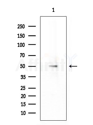 TRIM63 Antibody - Western blot analysis of extracts from EC304 cells, using TRIM63 Antibody at 1/1000 dilution.